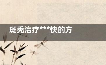 斑秃治疗***快的方法？？ 斑秃治疗***快的方法？